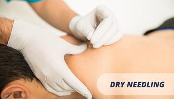 dry needling chiropractor North Vancouver